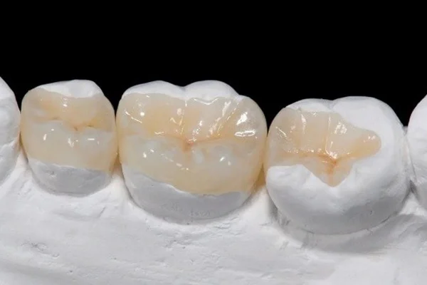 Prótese Dentária Dr. ana Clara Ribeiro 01