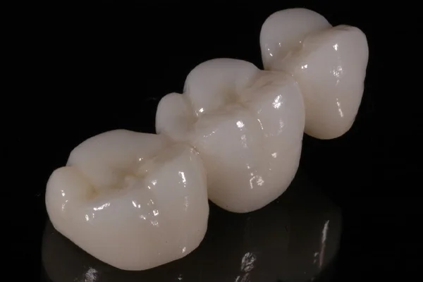 Prótese Dentária Dr. ana Clara Ribeiro 03